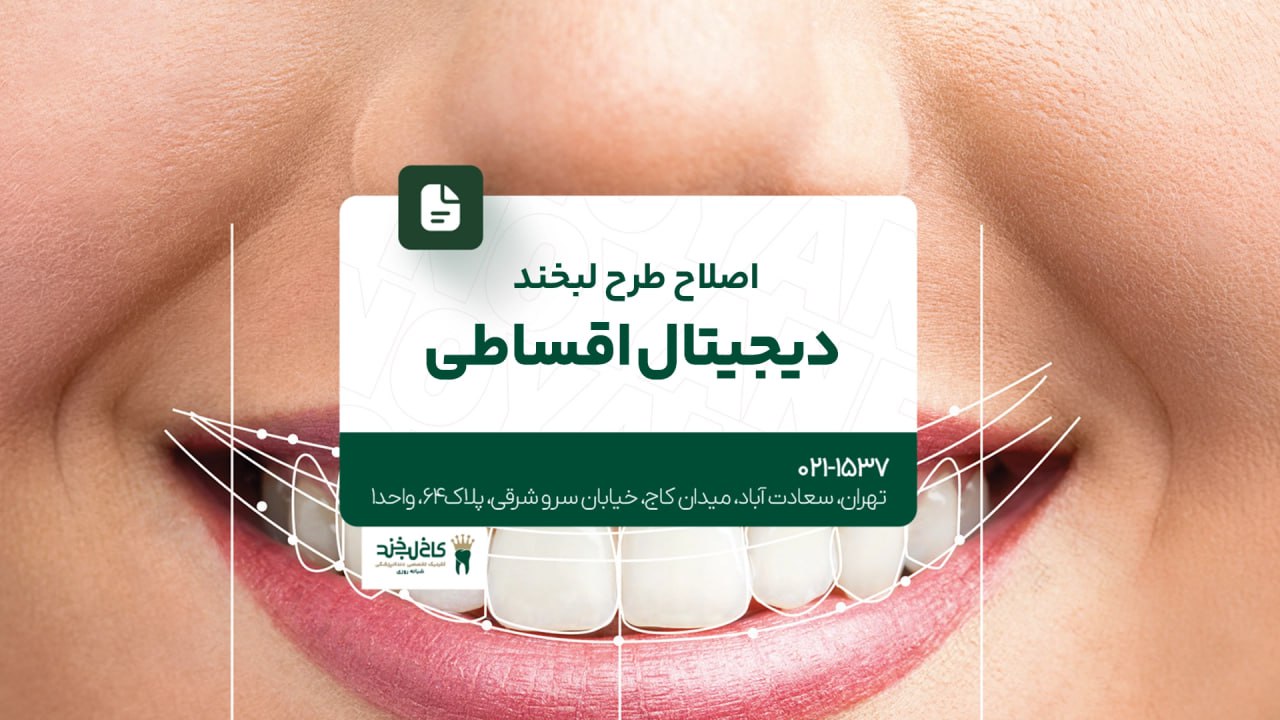 اصلاح طرح لبخند دیجیتال اقساطی