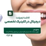 کاشت ایمپلنت دیجیتال در کلینیک تخصصی