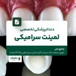 دندانپزشکی تخصصی لمینت سرامیکی