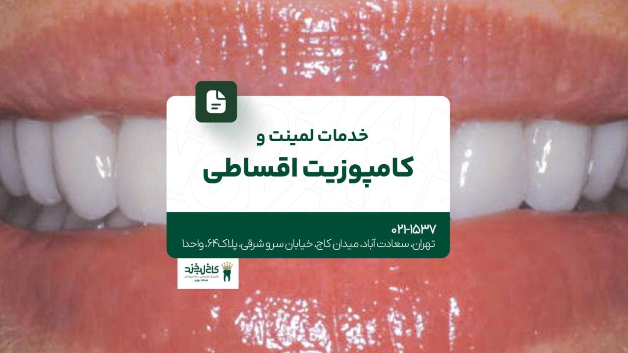 خدمات لمینت و کامپوزیت اقساطی خدمات لمینت و کامپوزیت اقساطی