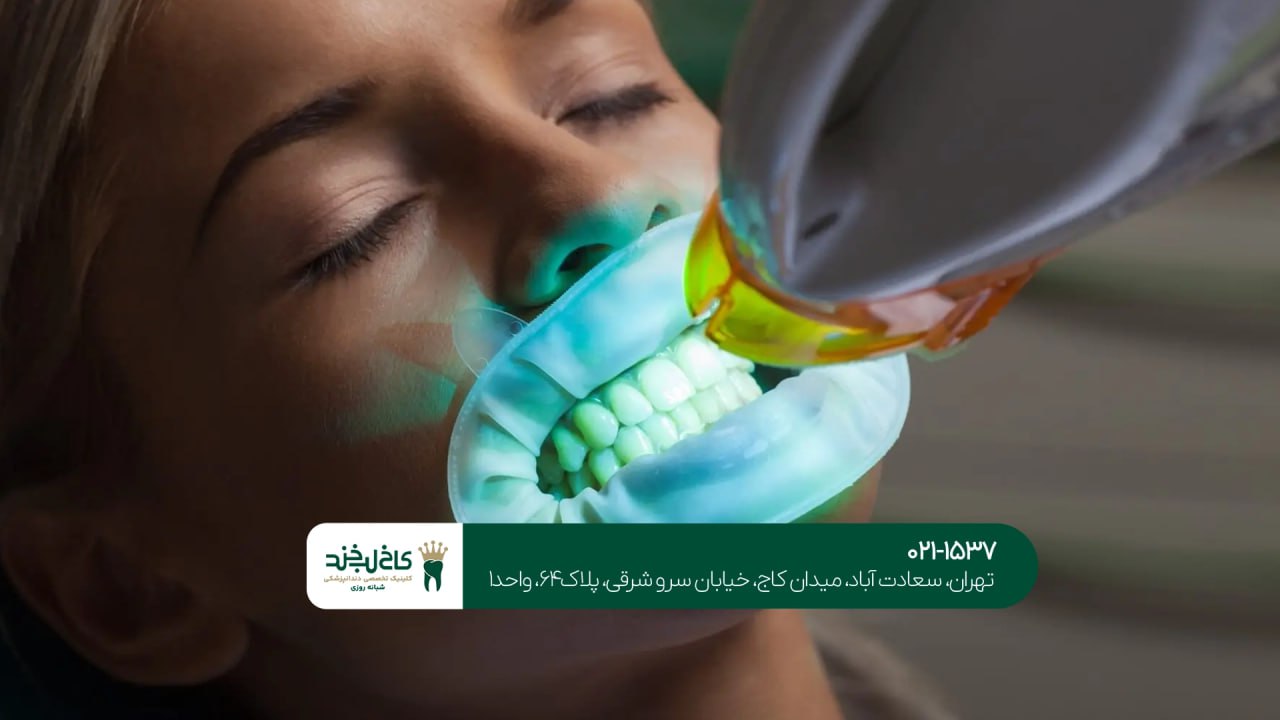 کلینیک تخصصی سفید کردن دندان کلینیک تخصصی سفید کردن دندان