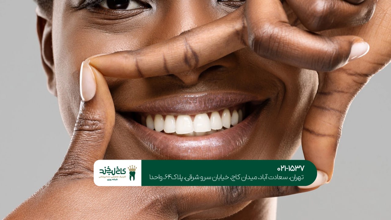 کلینیک تخصصی سفید کردن دندان کلینیک تخصصی سفید کردن دندان