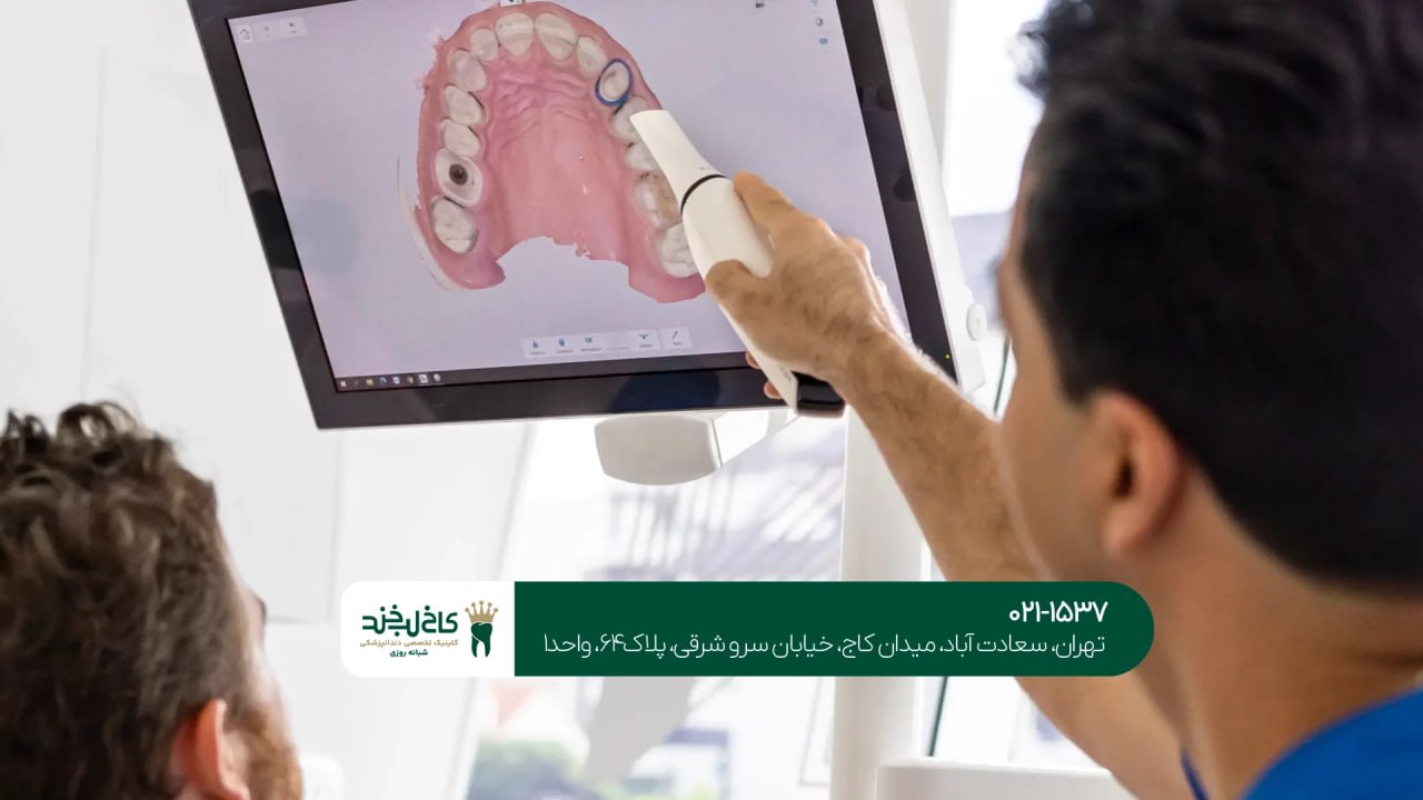 کاشت ایمپلنت با تکنولوژی مدرن کاشت ایمپلنت با تکنولوژی مدرن