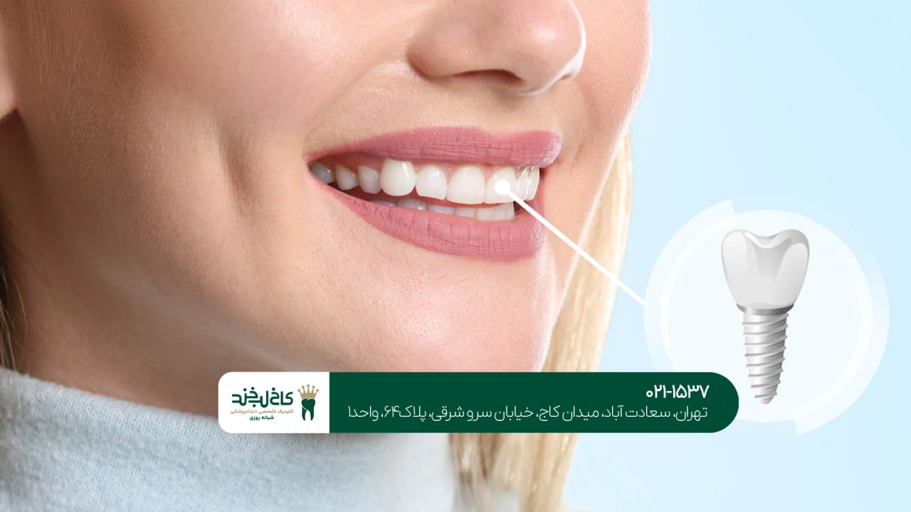 مرکز تخصصی ایمپلنت در سعادت آباد مرکز تخصصی ایمپلنت در سعادت آباد