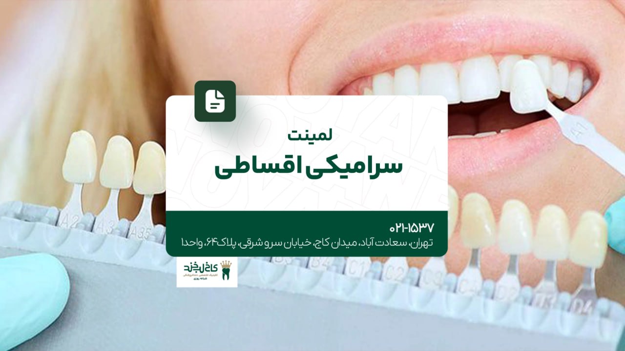 لمینت سرامیکی اقساطی لمینت سرامیکی اقساطی