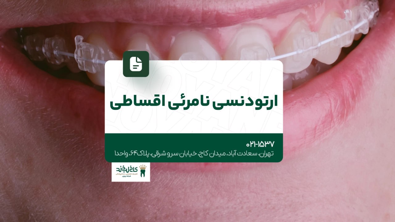 ارتودنسی نامرئی اقساطی ارتودنسی نامرئی اقساطی