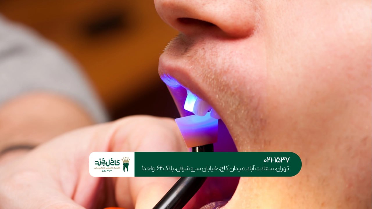 بهترین دندانپزشک اقساطی تهران بهترین دندانپزشک اقساطی تهران