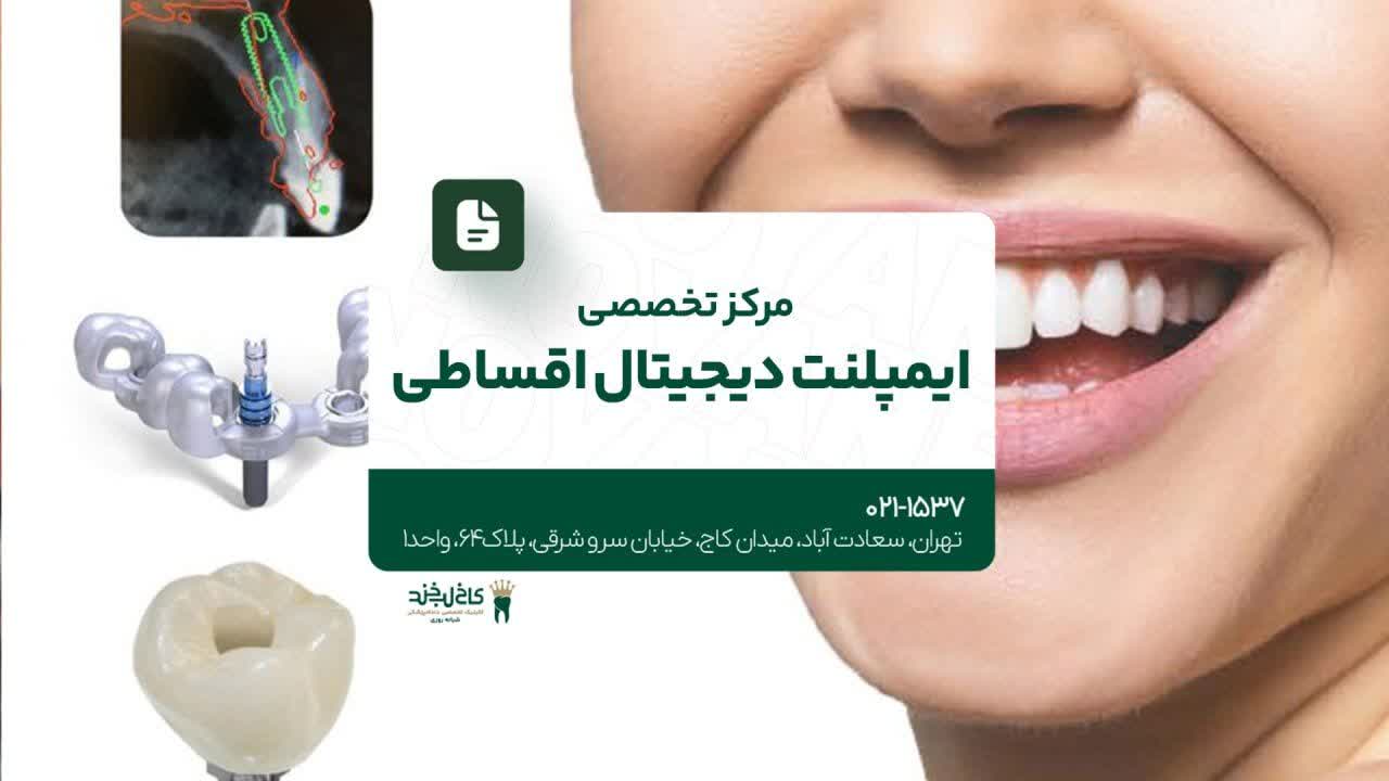 مرکز تخصصی ایمپلنت دیجیتال اقساطی مرکز تخصصی ایمپلنت دیجیتال اقساطی
