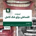ایمپلنت اقساطی برای فک کامل