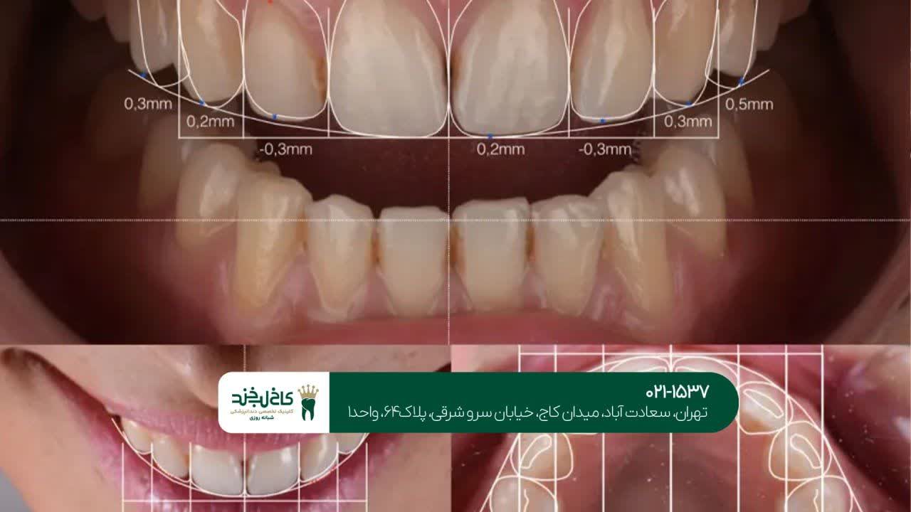 خدمات تخصصی اصلاح لبخند اقساطی
