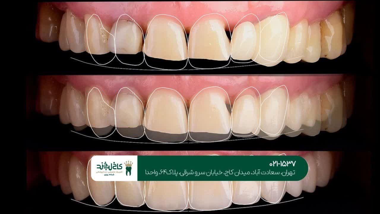 خدمات تخصصی اصلاح لبخند اقساطی