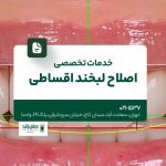 خدمات تخصصی اصلاح لبخند اقساطی