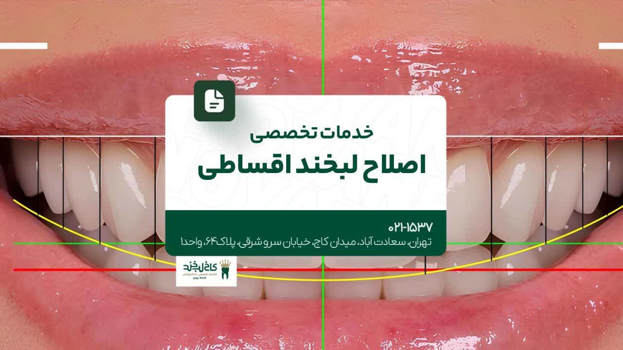 خدمات تخصصی اصلاح لبخند اقساطی