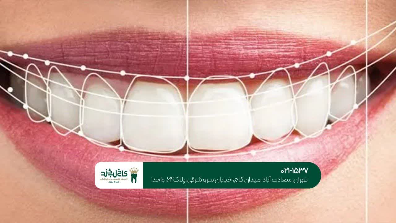 خدمات تخصصی اصلاح لبخند اقساطی