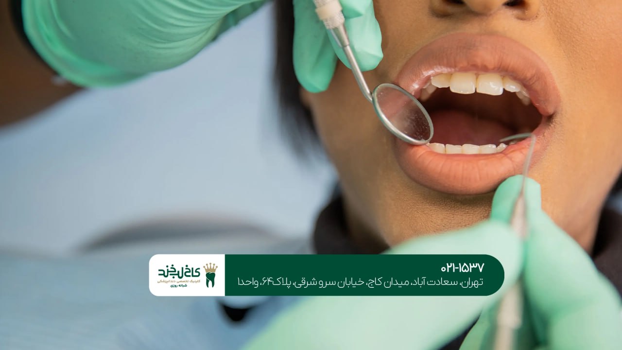 دندانپزشکی زیبایی با پرداخت اقساطی دندانپزشکی زیبایی با پرداخت اقساطی