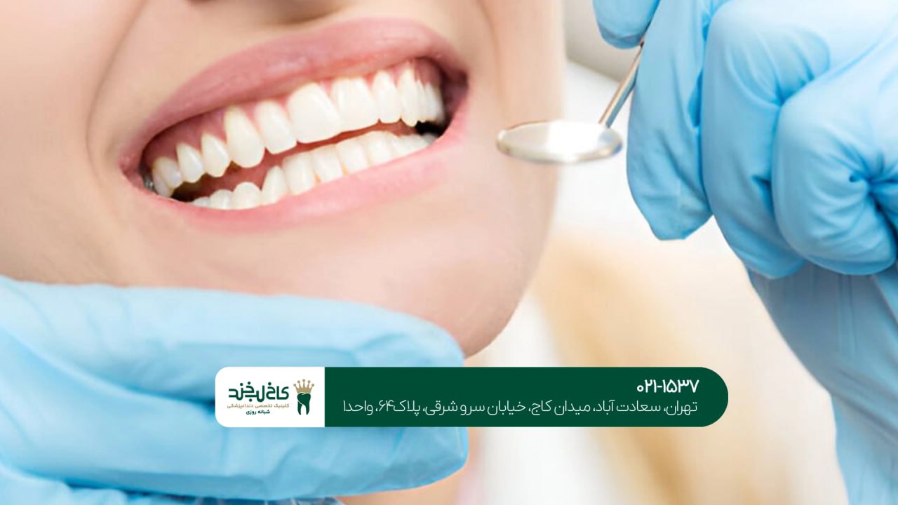 دندانپزشکی زیبایی با پرداخت اقساطی دندانپزشکی زیبایی با پرداخت اقساطی