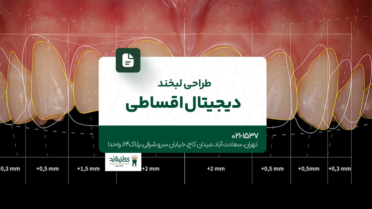 طراحی لبخند دیجیتال اقساطی