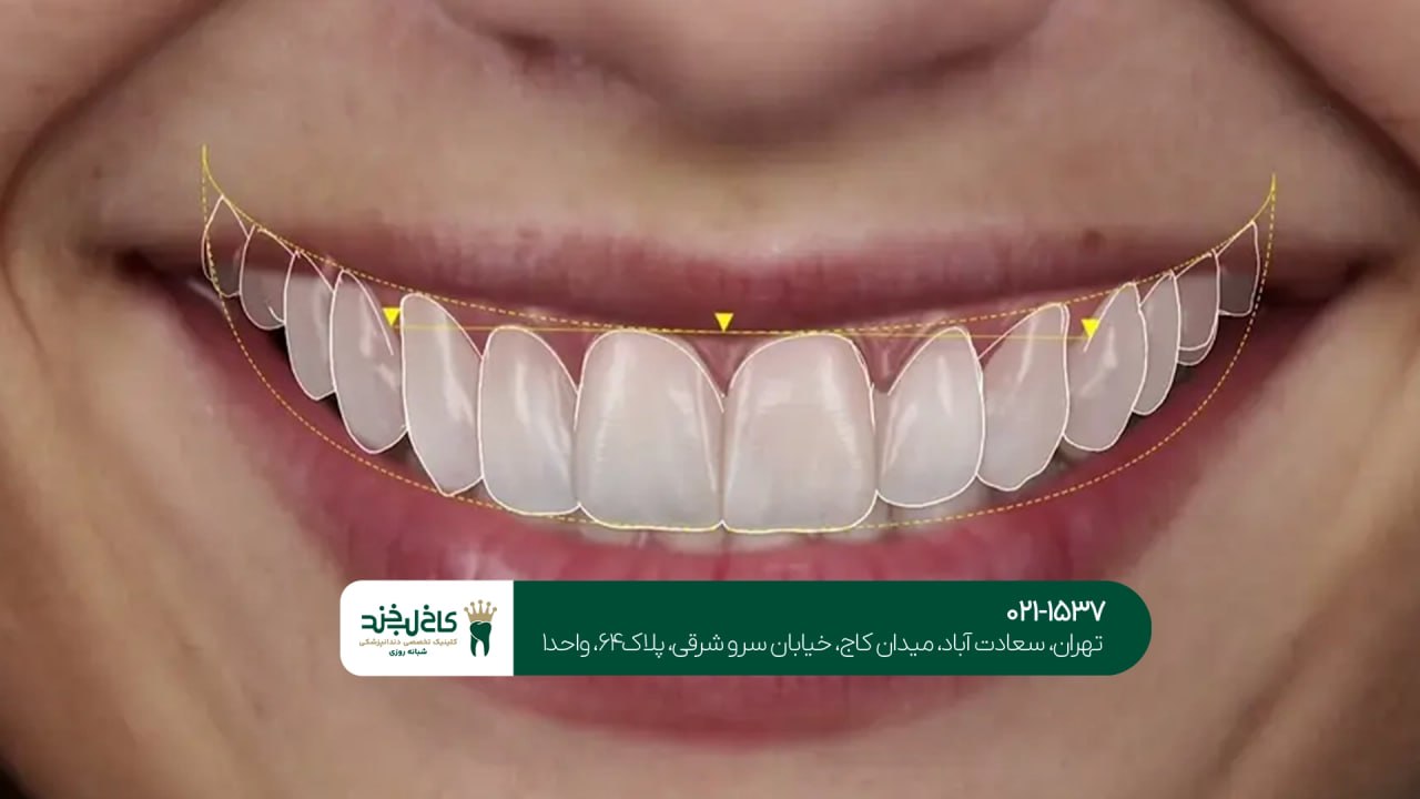 دندانپزشکی حرفه ای برای اصلاح طرح لبخند دندانپزشکی حرفه ای برای اصلاح طرح لبخند
