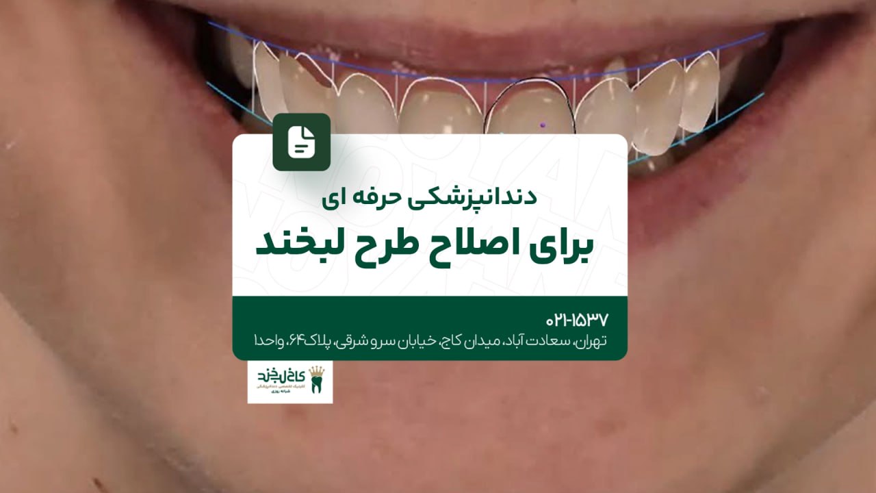 دندانپزشکی حرفه ای برای اصلاح طرح لبخند