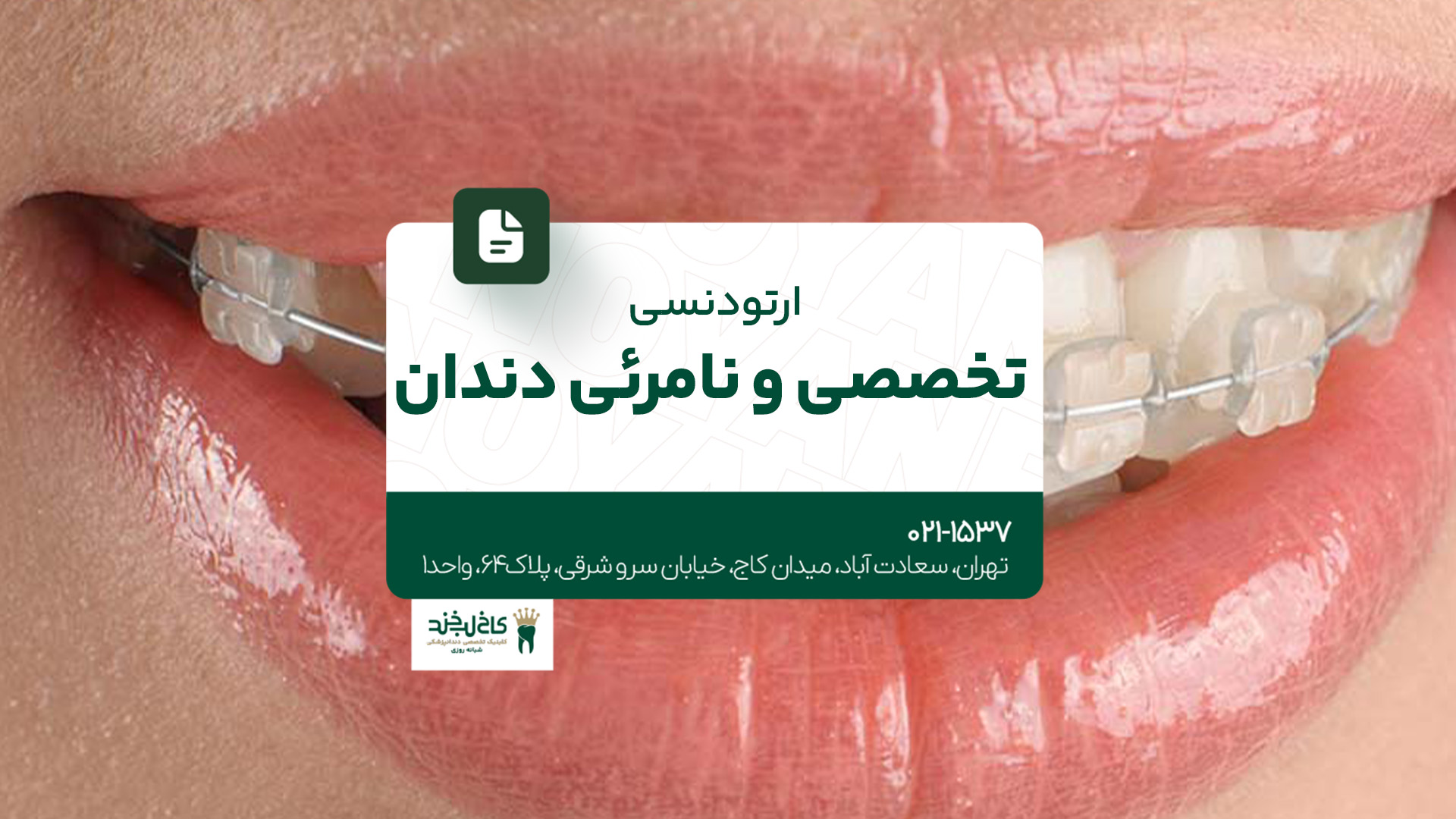 ارتودنسی تخصصی و نامرئی دندان ارتودنسی تخصصی و نامرئی دندان