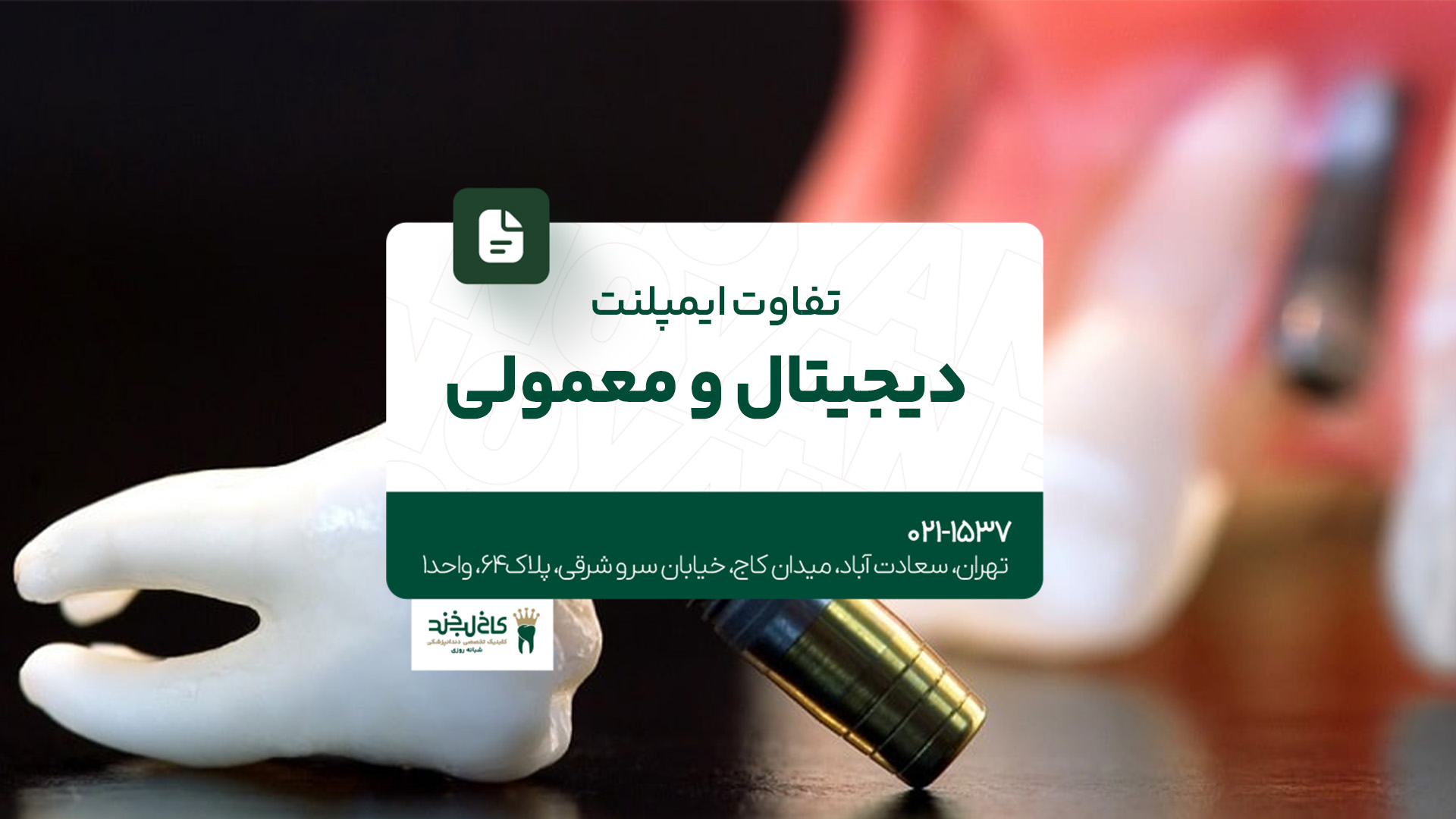 تفاوت ایمپلنت دیجیتال و معمولی تفاوت ایمپلنت دیجیتال و معمولی