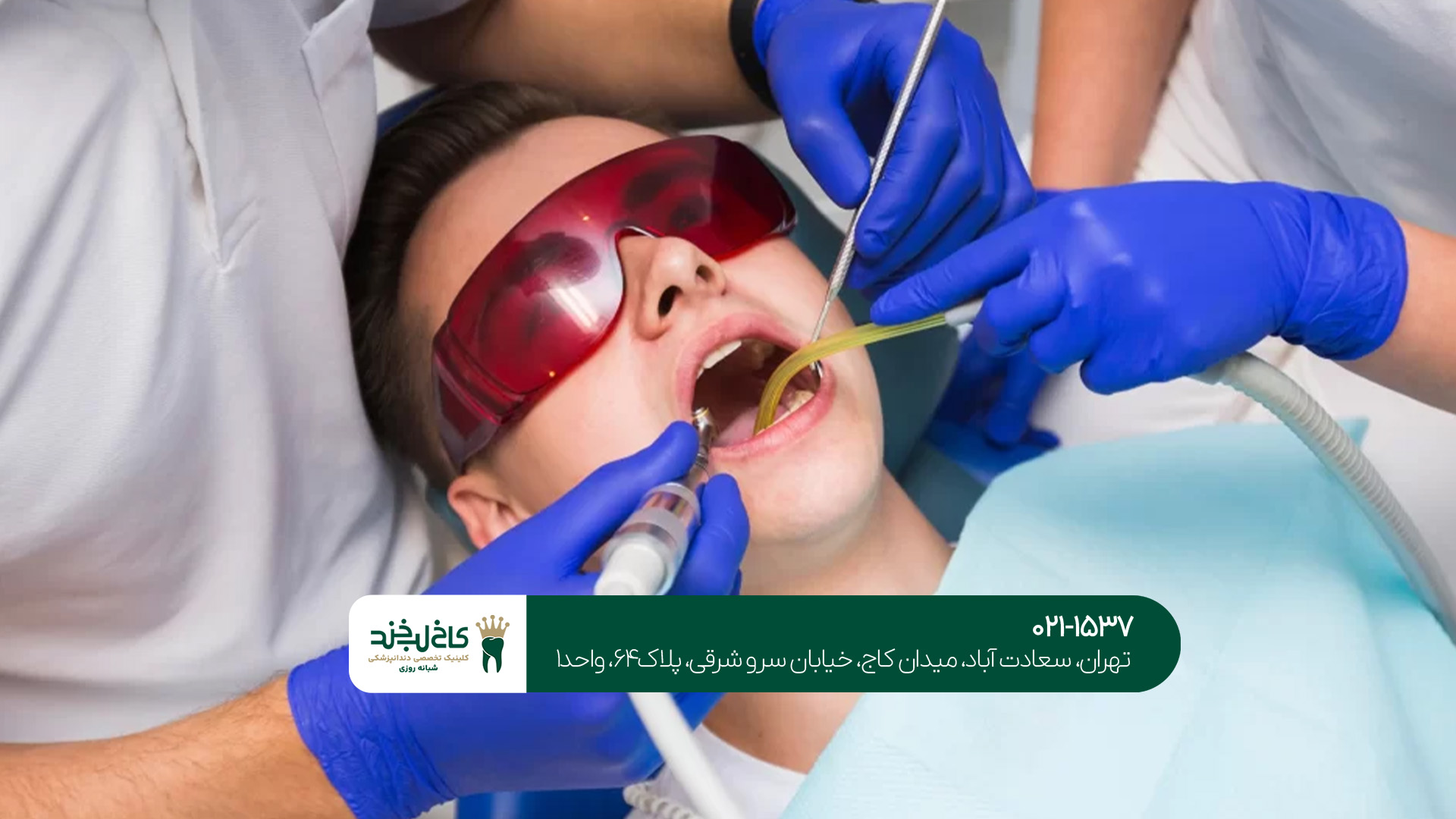 هزینه درمان ریشه دیجیتال هزینه درمان ریشه دیجیتال