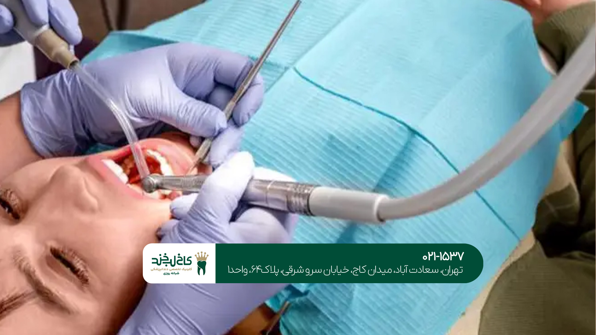 هزینه درمان ریشه دیجیتال هزینه درمان ریشه دیجیتال