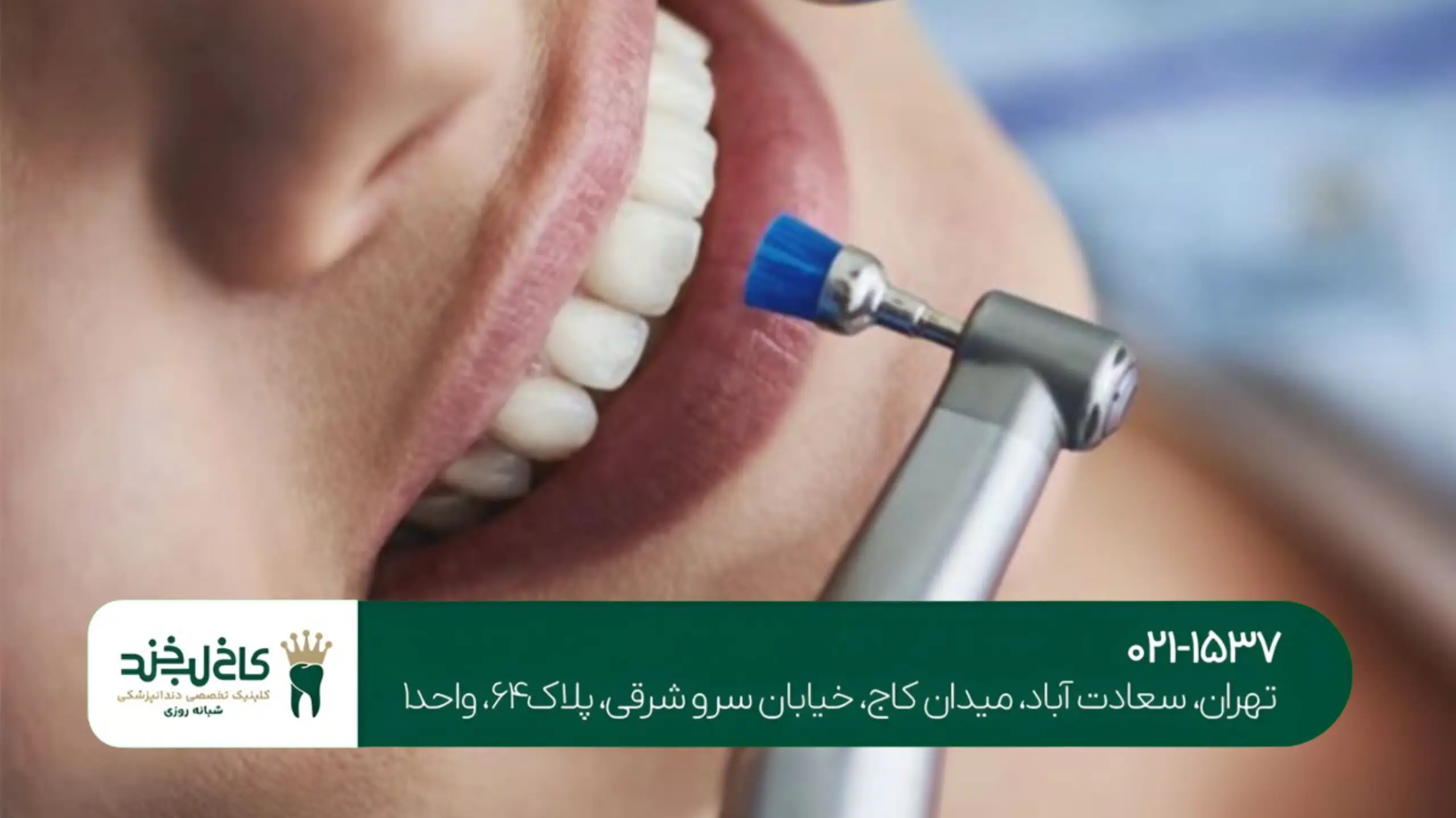 بهترین دندانپزشکی شمال تهران