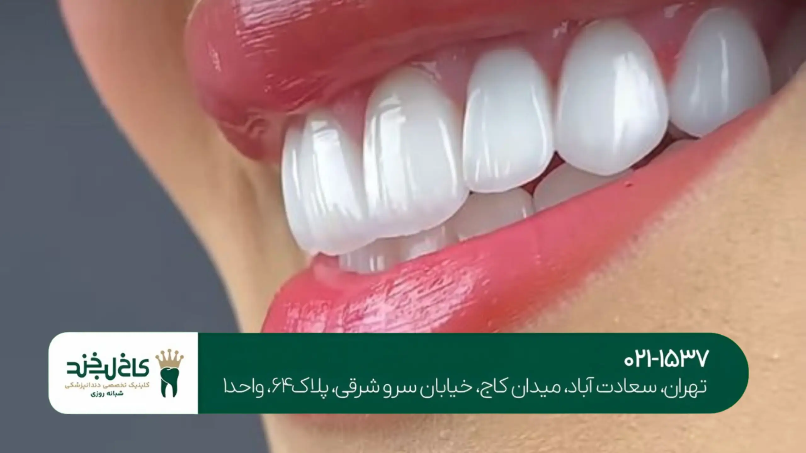 بهترین دندانپزشکی زیبایی تهران