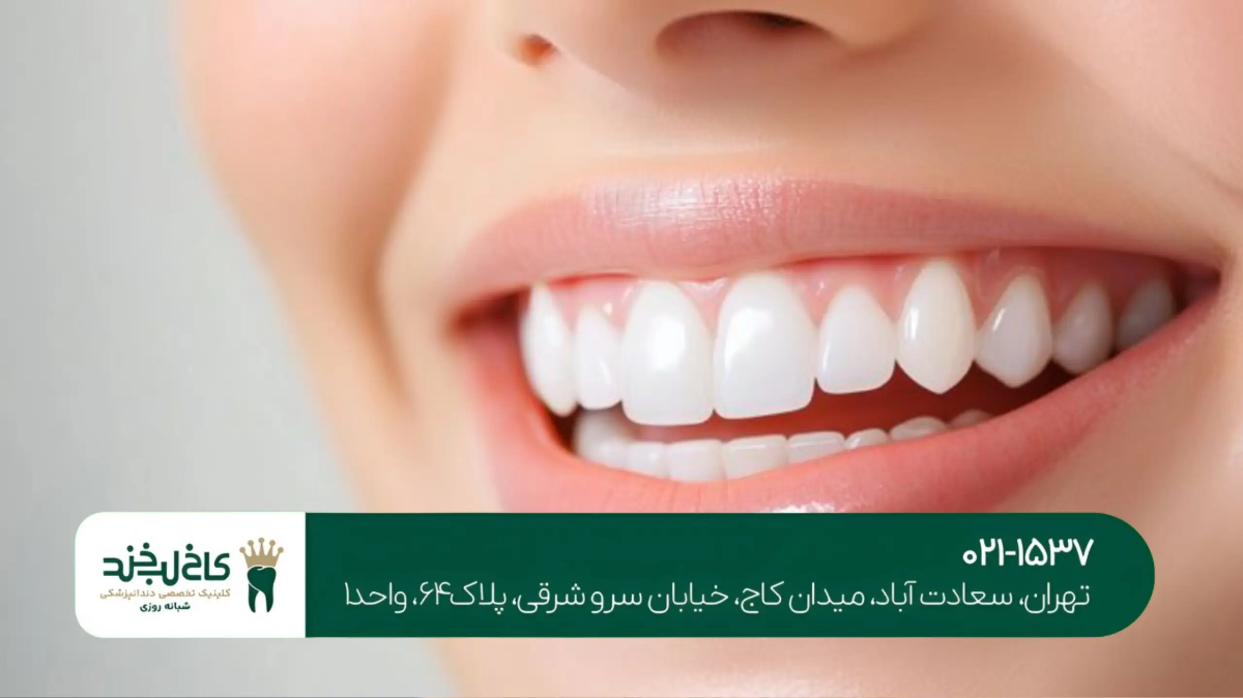 بهترین دندانپزشکی زیبایی تهران