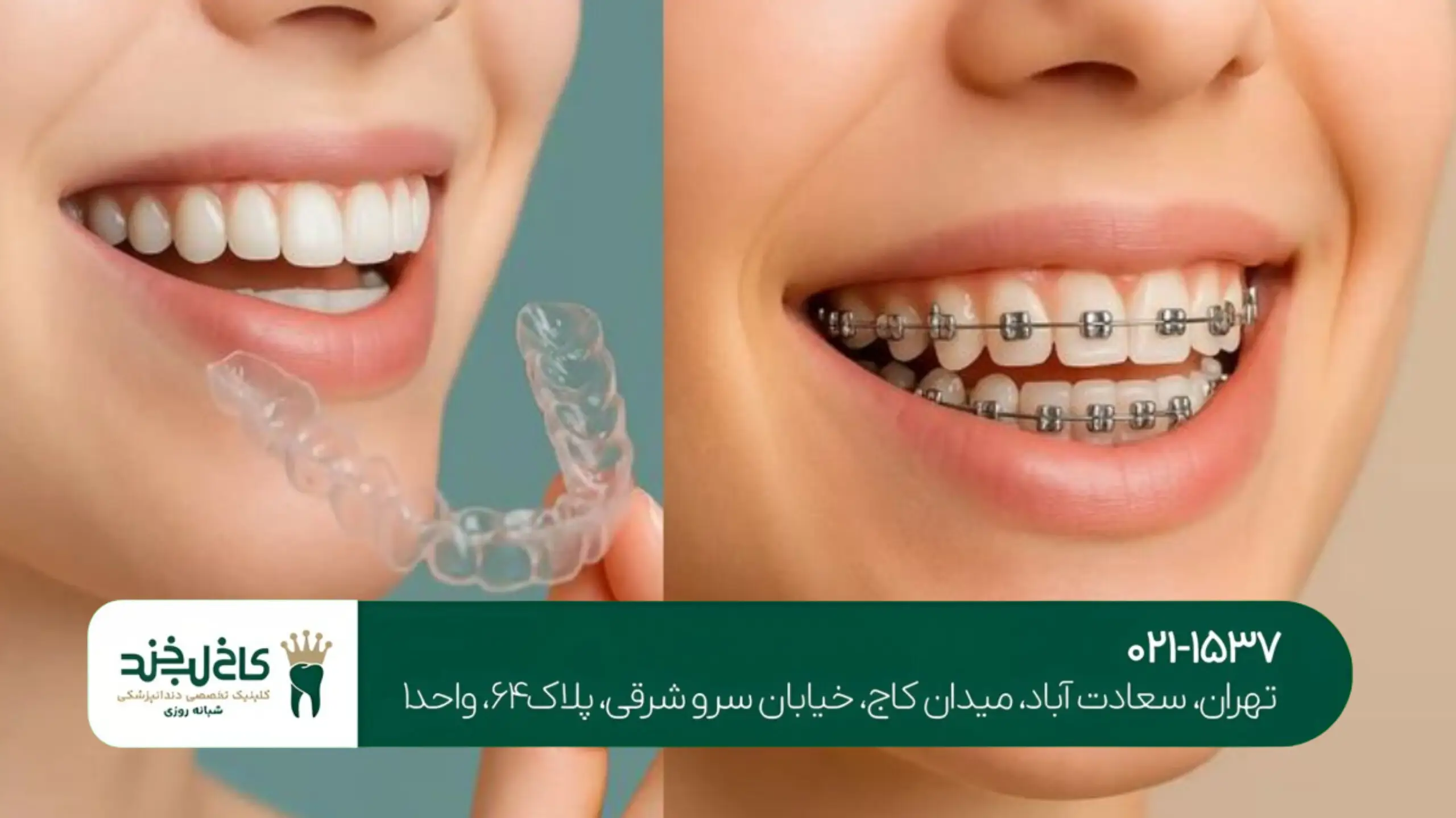 بهترین دندانپزشکی سعادتآباد