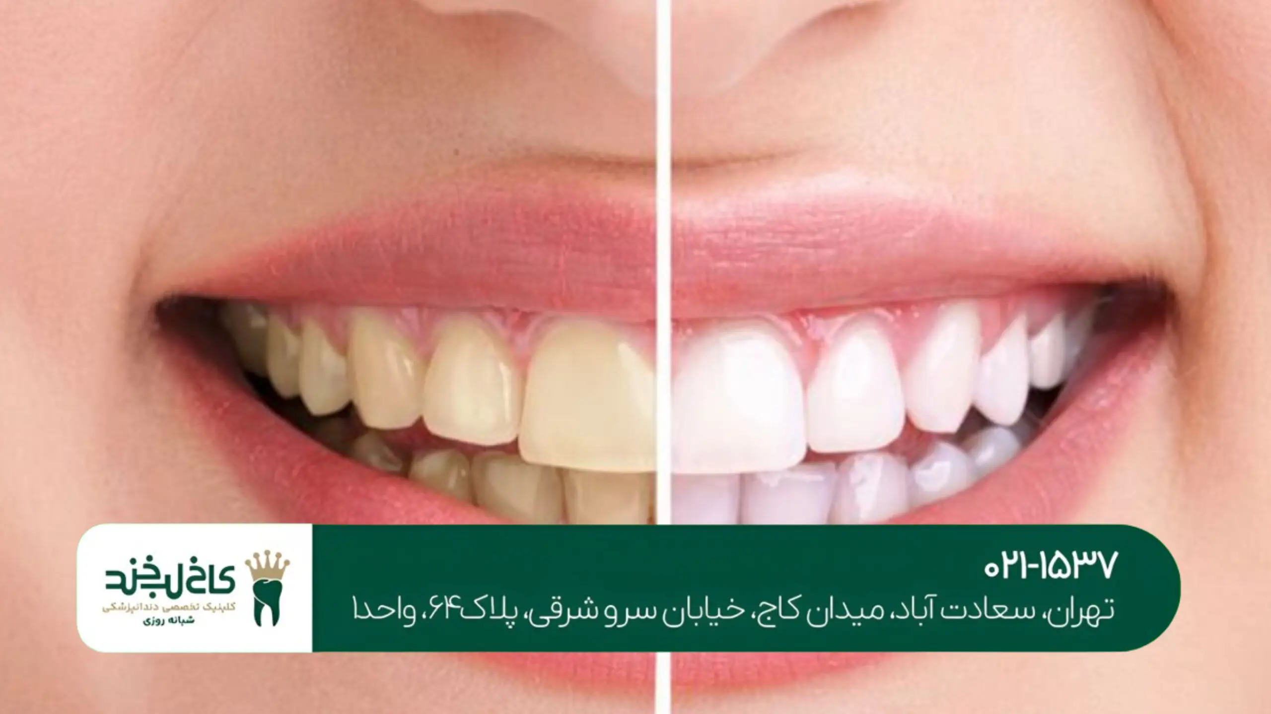 بهترین دندانپزشکی سعادتآباد