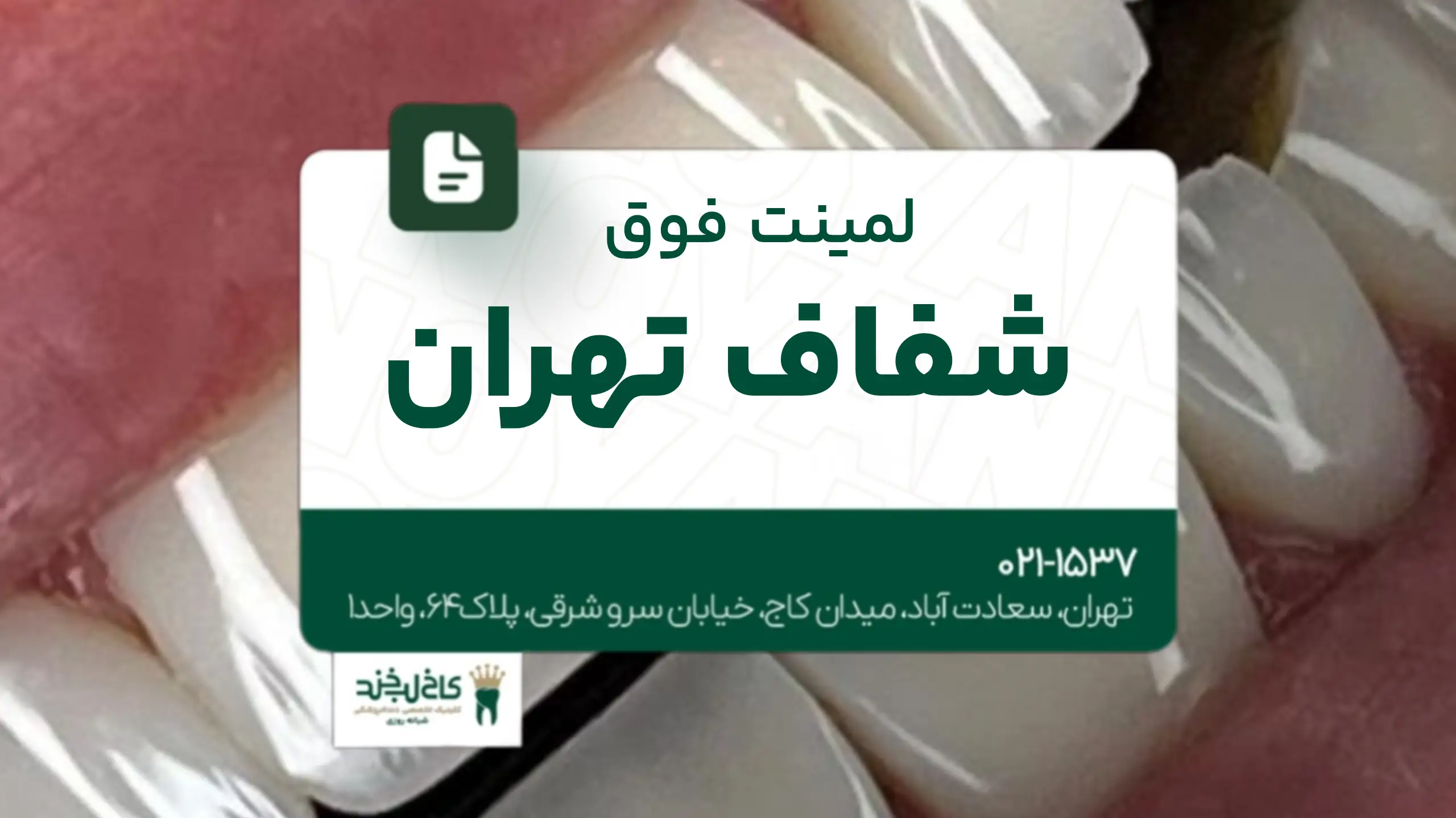 لمینت فوق شفاف تهران