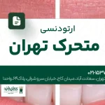 ارتودنسی متحرک تهران