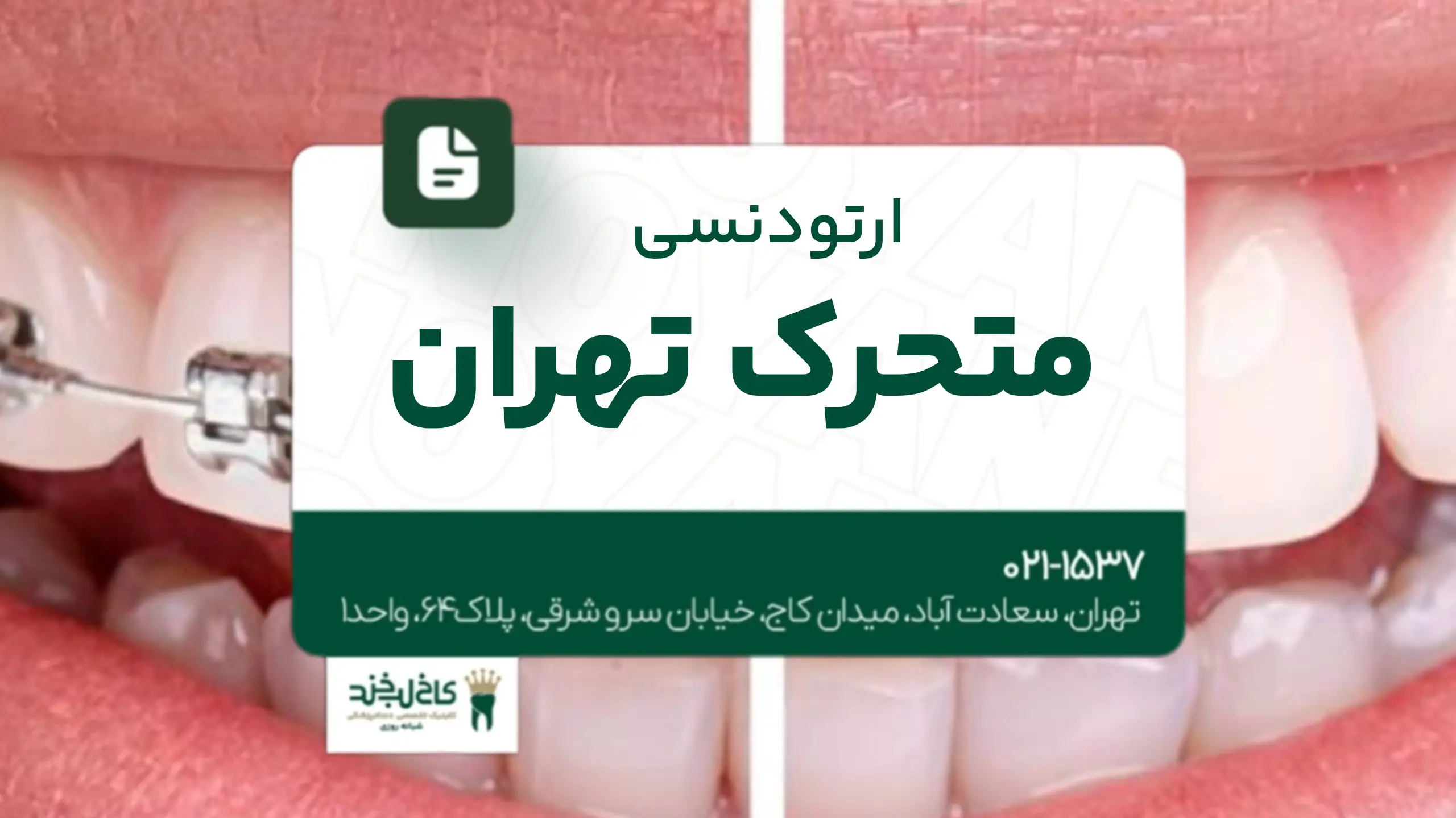 ارتودنسی متحرک تهران