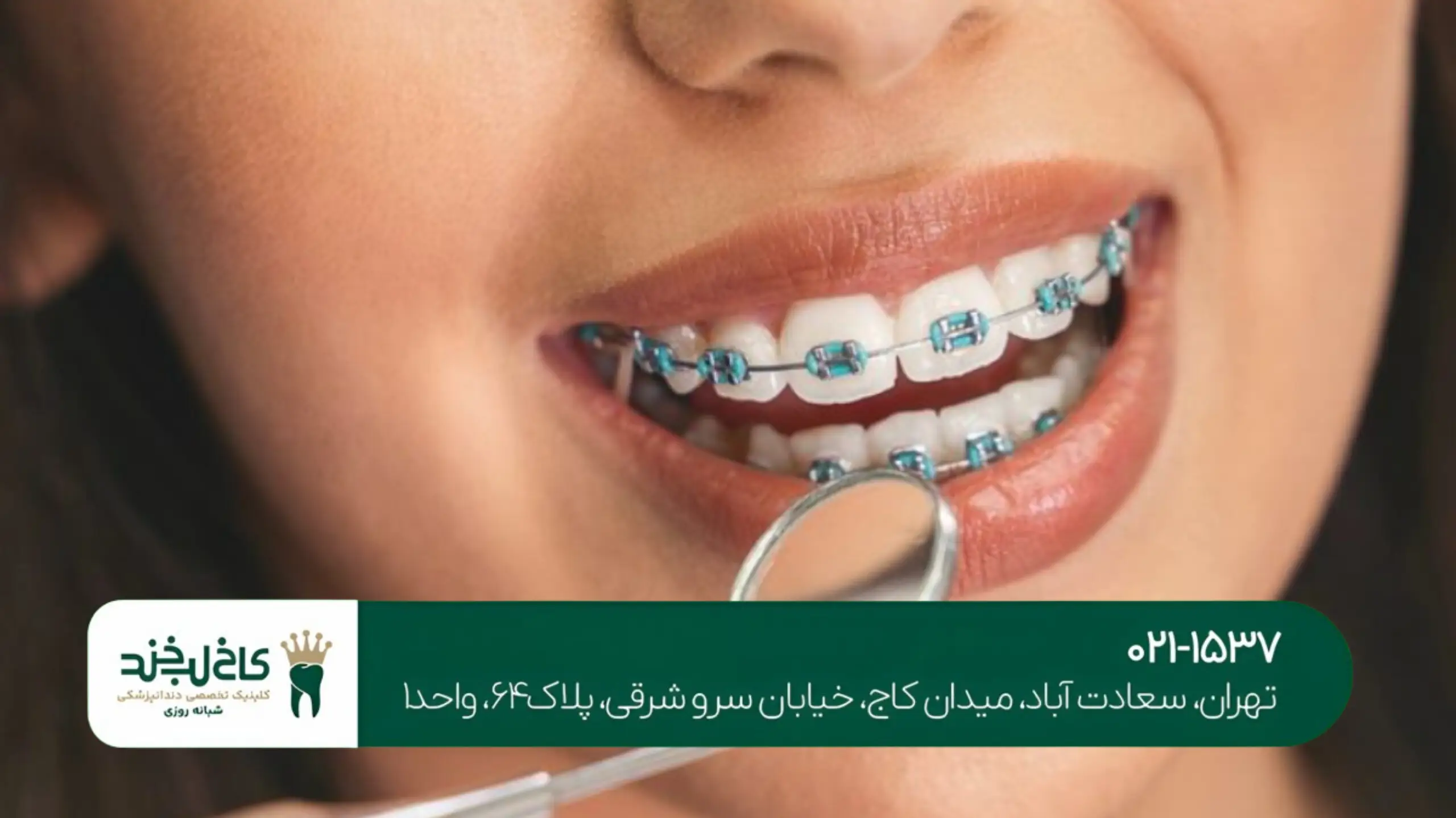 ارتودنسی متحرک تهران