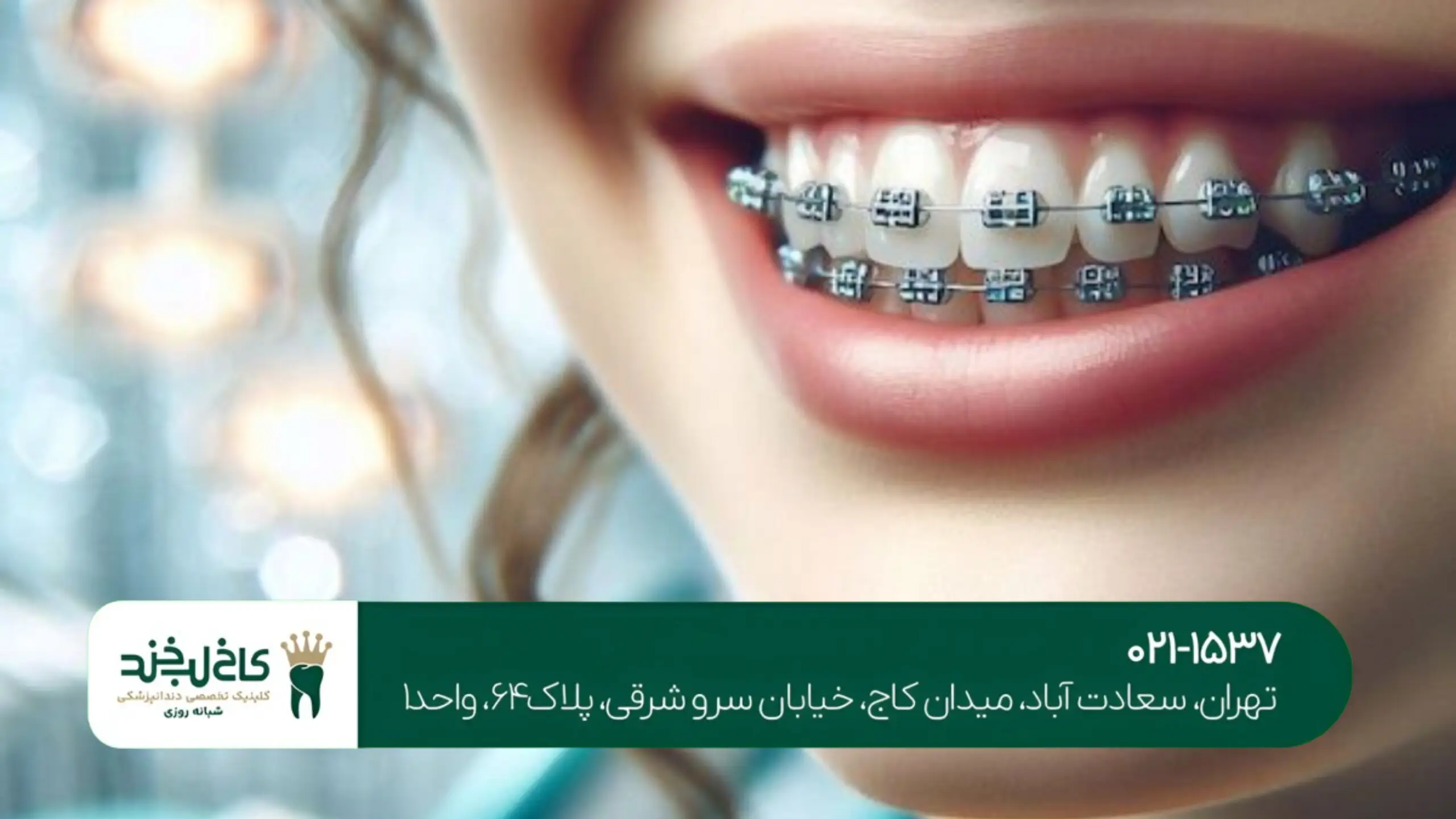 ارتودنسی متحرک تهران