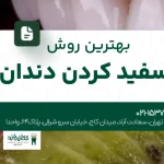  بهترین روش سفید کردن دندان