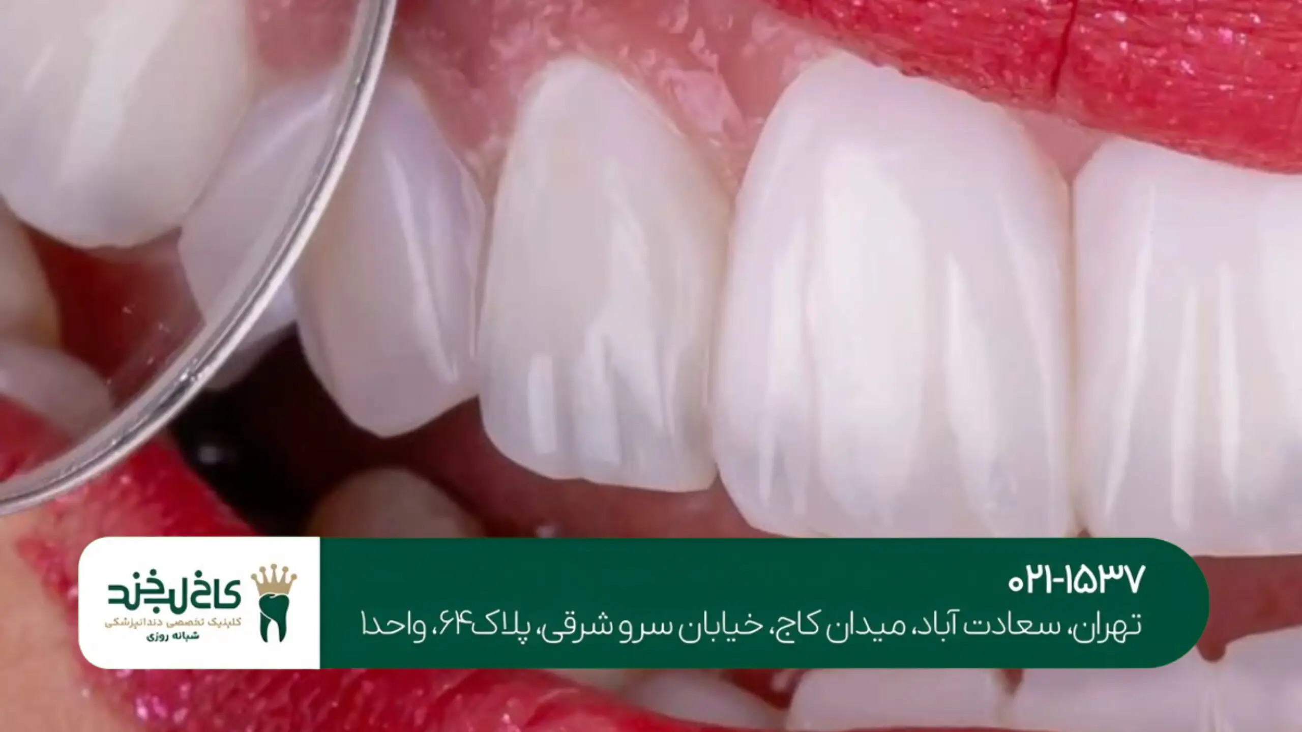 خدمات دندانپزشکی کامل