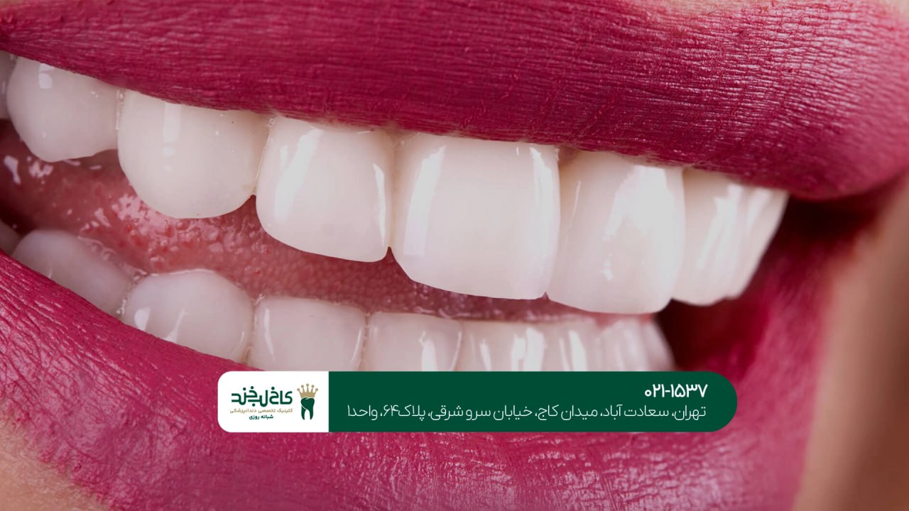 مشاوره اصلاح طرح لبخند