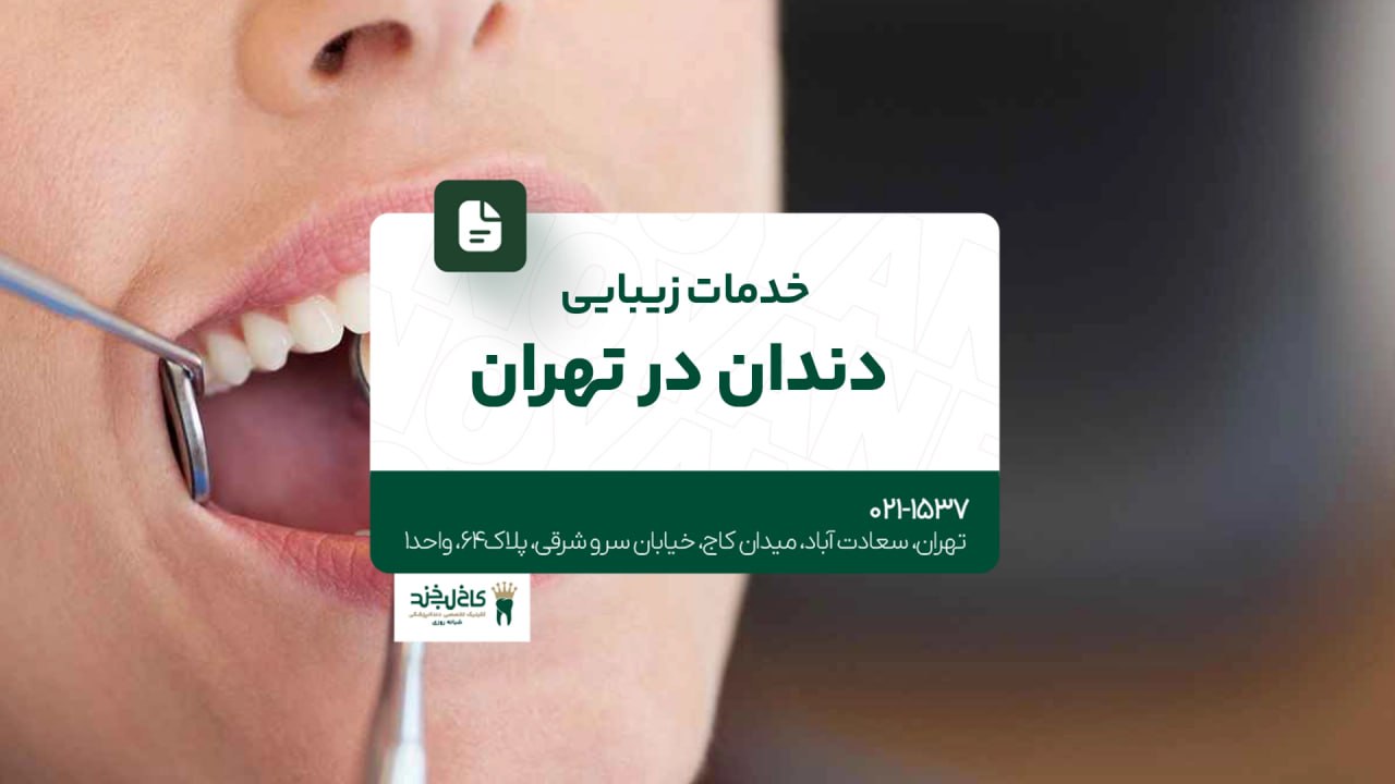 خدمات زیبایی دندان در تهران