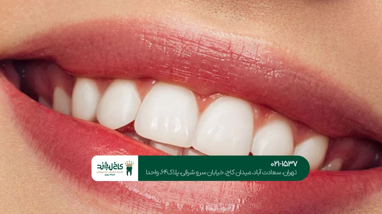 مشاوره دندانپزشکی زیبایی