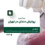 جرمگیری و پولیش دندان در تهران