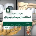 ایمپلنت دندان با استفاده از سیستم دیجیتال