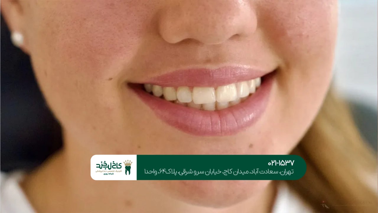 مشاوره دندانپزشکی زیبایی