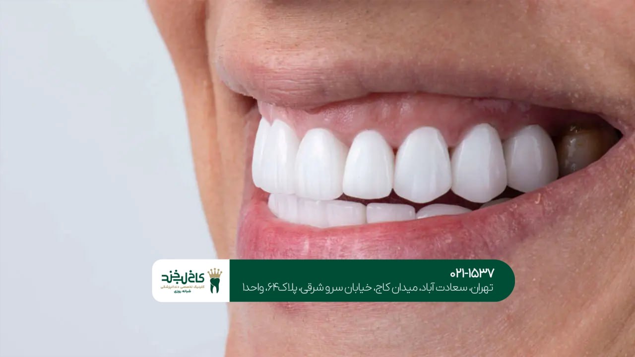 مشاوره دندانپزشکی زیبایی