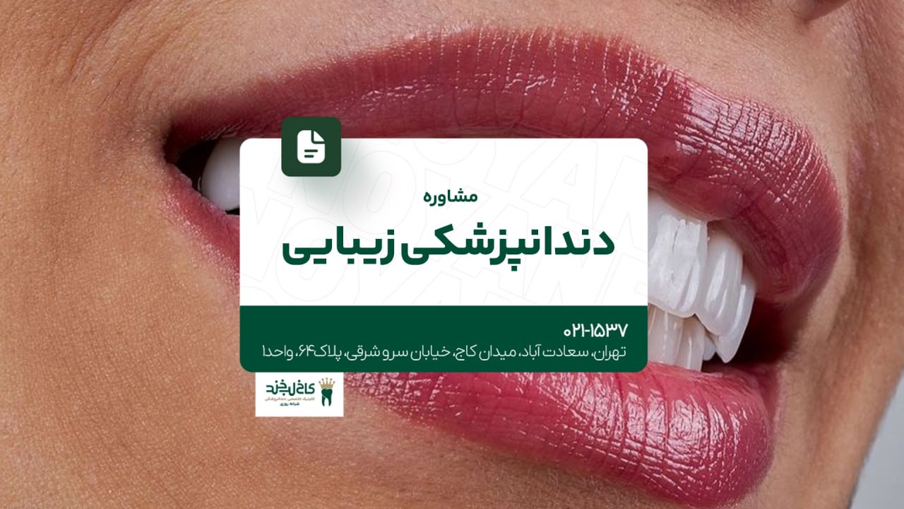 مشاوره دندانپزشکی زیبایی