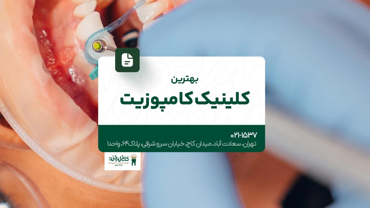 بهترین کلینیک کامپوزیت دندان