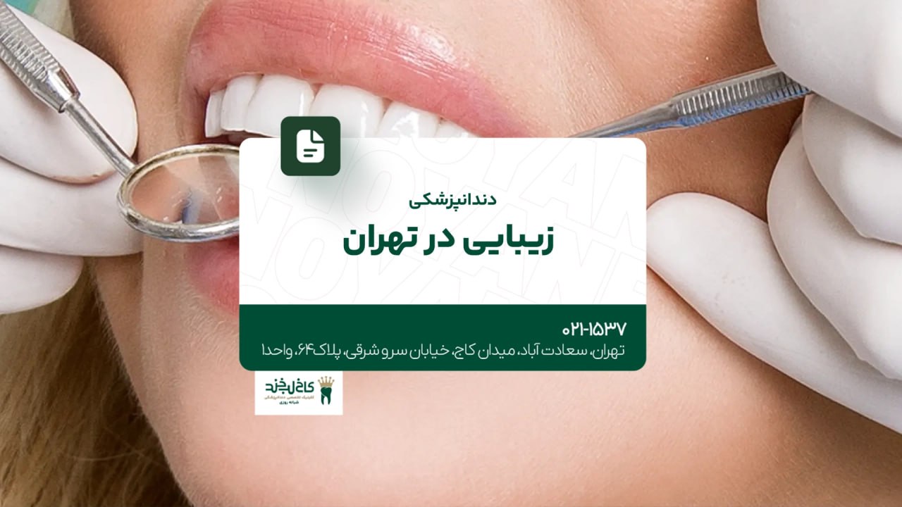 دندانپزشکی زیبایی در تهران