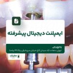 ایمپلنت دیجیتال پیشرفته